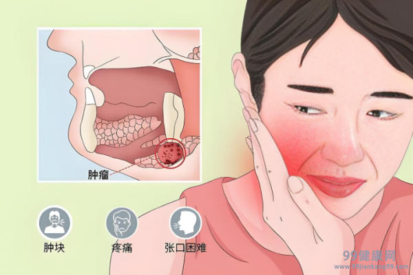 口腔鳞状细胞癌怎么回事