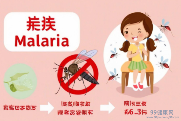 疟疾症状 疟疾有什么表现