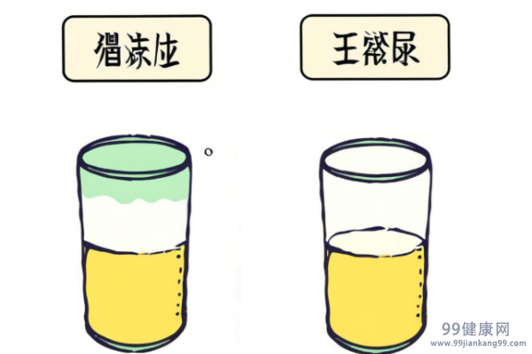 尿液有点浑浊是什么原因