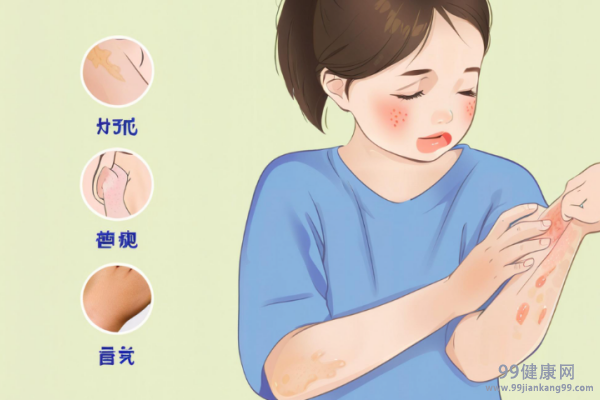 疱疹怎么治疗好得快 疱疹用什么
