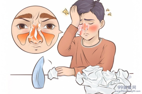 鼻炎是怎么引起的 鼻炎的常见引
