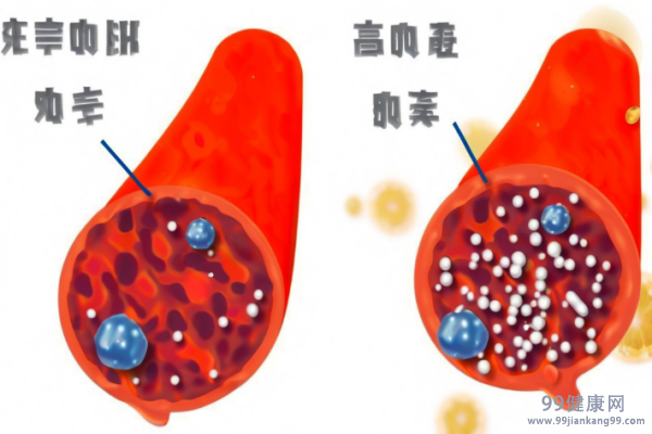 怀孕血糖高对孩子有什么影响