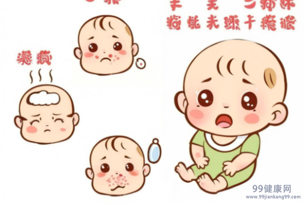 手足口病会发烧吗 手足口病发烧