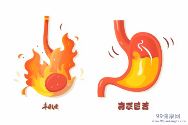 反流性食管炎的症状 反流性食管