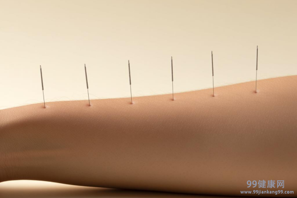 中医针灸减肥会不会反弹,针灸减肥注意事项